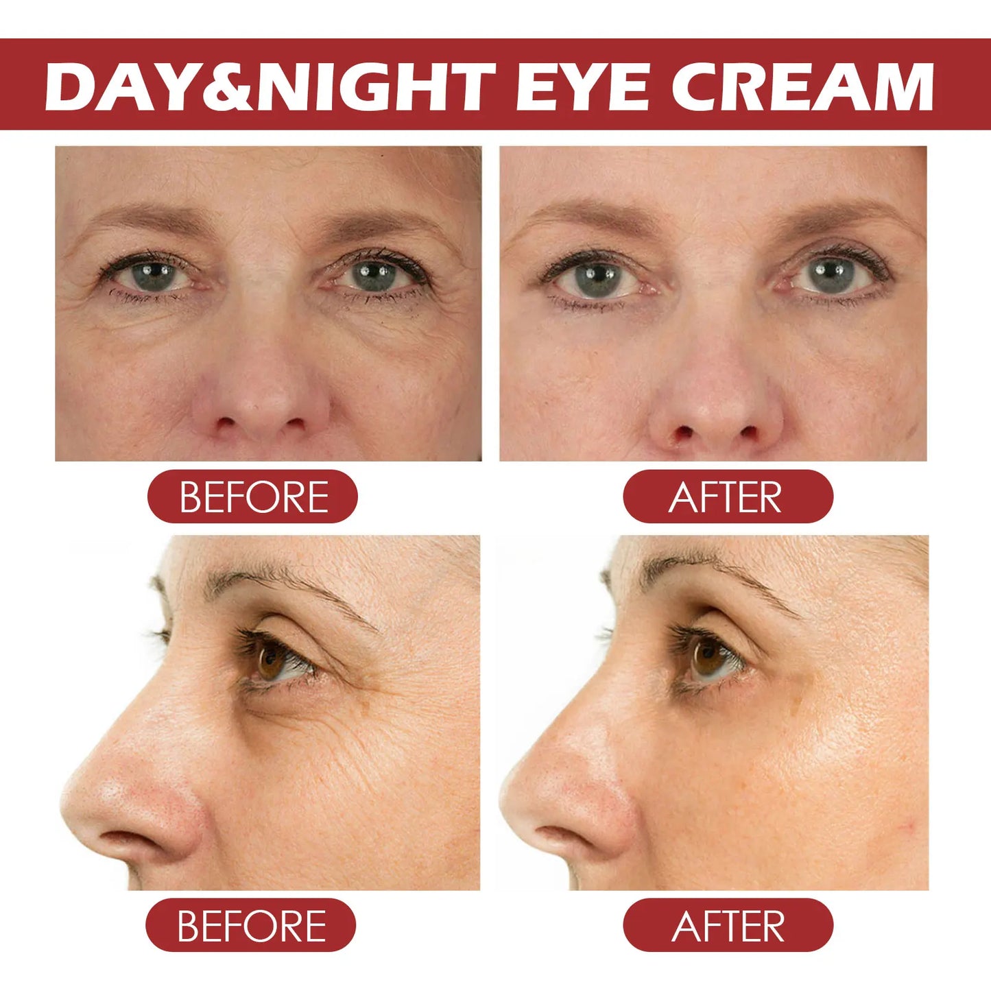 Bastão Anti-Rugas para Olhos com Retinol e Colágeno — Apaga Olheiras e Pés de Galinha